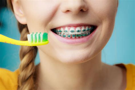 brushing  braces     braces clean jiva dental