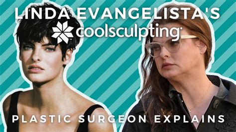 plastic surgeon explains linda evangelistas coolsculpting  left