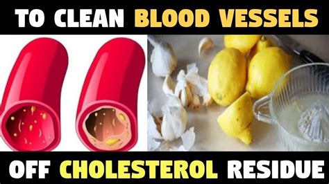 days treatment  clean  blood vessels  cholesterol