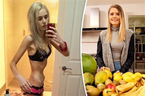 anorexic teen starved self for a week and was hours away from death daily star