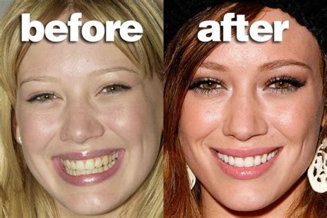 care   skin   simple steps celebrity teeth