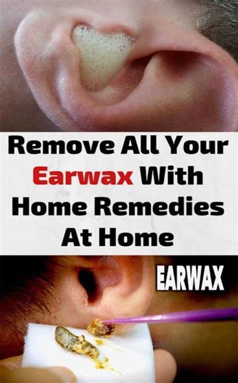 how to use hydrogen peroxide to remove ear wax in 2020 ear wax ear