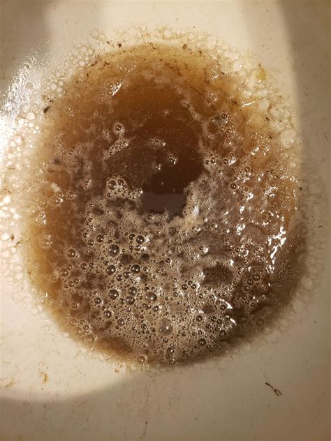 Why Does My Puke Look Like This After Doing Fent R Opiates