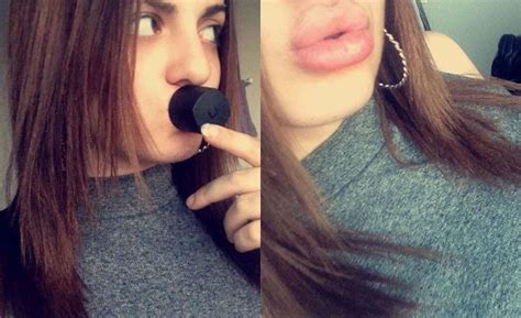 la peligrosa moda para tener los labios de kylie jenner qué es