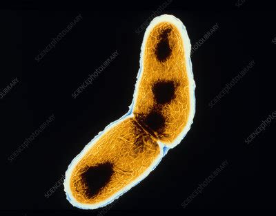 tuberculosis bacterium stock image  science photo library