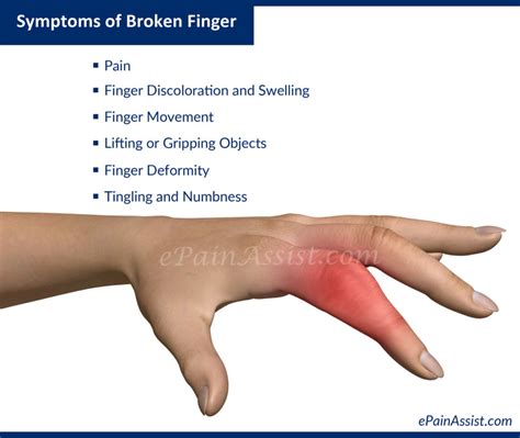 broken fingers causes diagnosis and treatment health life media
