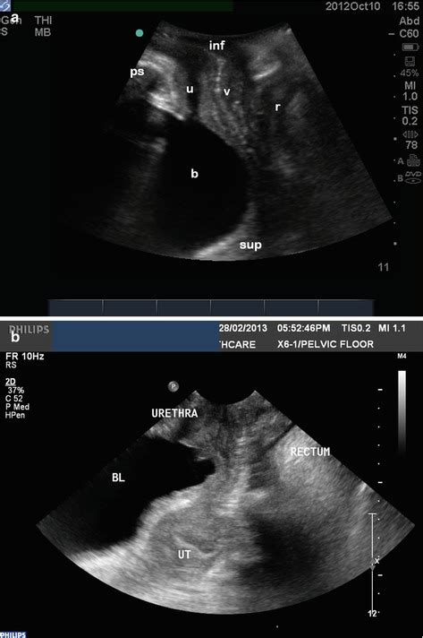 Practical Application Of Ultrasound In The Assessment Of