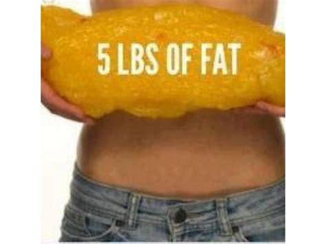 This Is The Reality Of What 5 Lbs Of Fat Is Imagine If Your 10 20