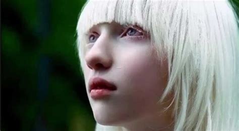 science  albinism collegefreakz