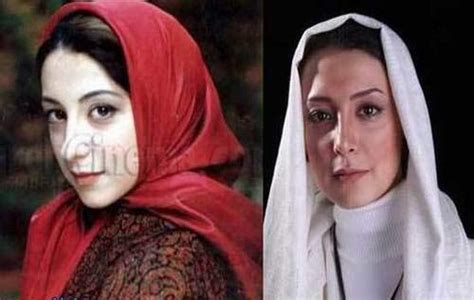 عکسهای لو رفته بازیگران زن ایرانی قبل از عمل زیبایی