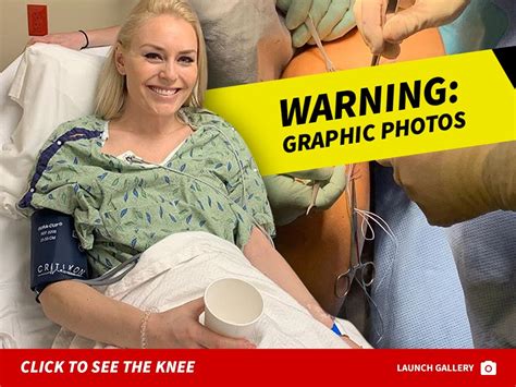 lindsey vonn disgusting picture  knee  lcl surgery