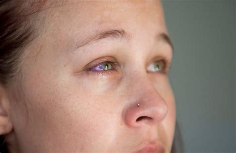 Eyeball Tattoos Could Lead To Blindness And Severe Infections Doctors