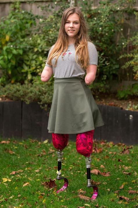 Teenage Amputee Who Lost All Four Limbs To Meningitis Wins