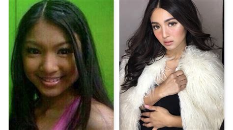 Nadine Lustre Before And After Extreme Plastic Surgery