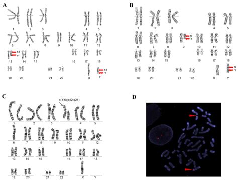 Y Chromosome Under Microscope Micropedia
