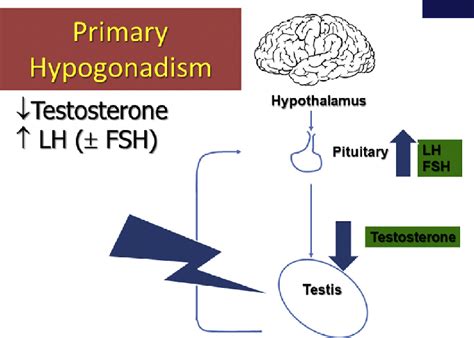 primary hypogonadism fsh ¼ follicle stimulating hormone