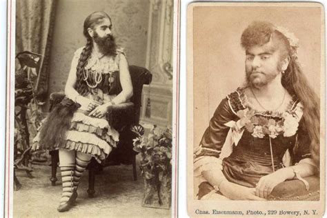 9 Famous Freak Show Acts And Their Stories Of Exploitation And Tragedy