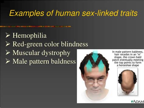 Ppt Sex Linked Traits Powerpoint Presentation Free Download Id 6782323