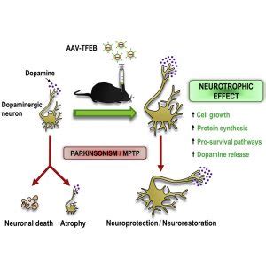 find     stop parkinsons progression  revert  symptoms parkinson unveiled