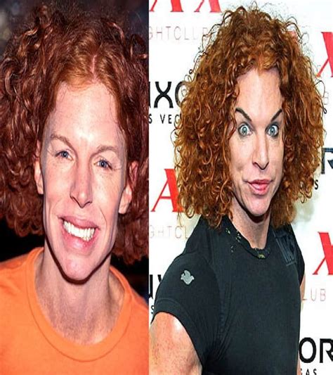 worst cases  celebrity plastic surgery  wrong