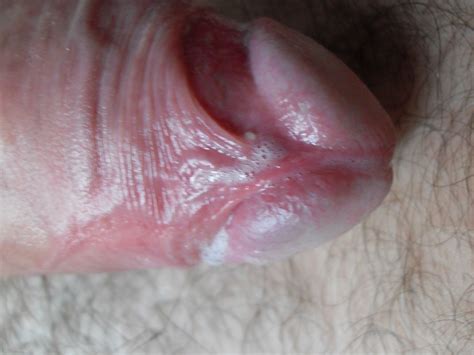 3  In Gallery Close Up Of My Cock Head With Pre Cum