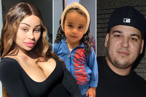 blac chyna claims dream suffered severe burns at rob kardashian s house