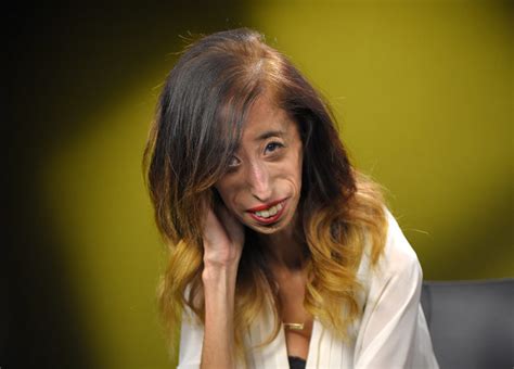 Lizzie Velasquez Once Dubbed ‘world’s Ugliest Woman ’ Shares How She