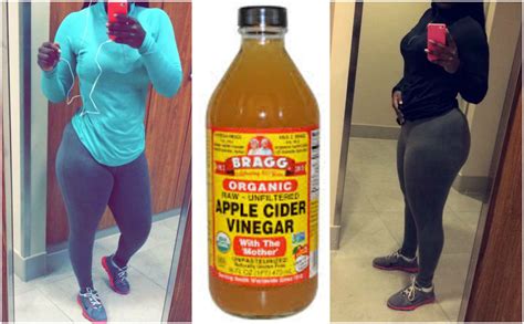 How To Lose Weight With Apple Cider Vinegar And Other Tips Kamdora