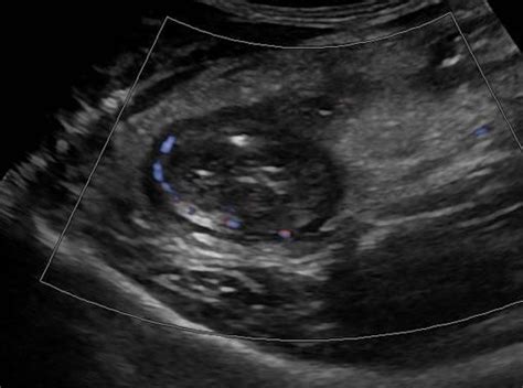 Abdomen And Retroperitoneum 1 6 Gastrointestinal Tract Case 1 6 4