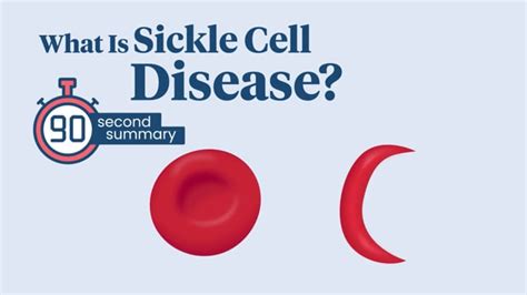 sickle cell disease  kids rady childrens hospital xml