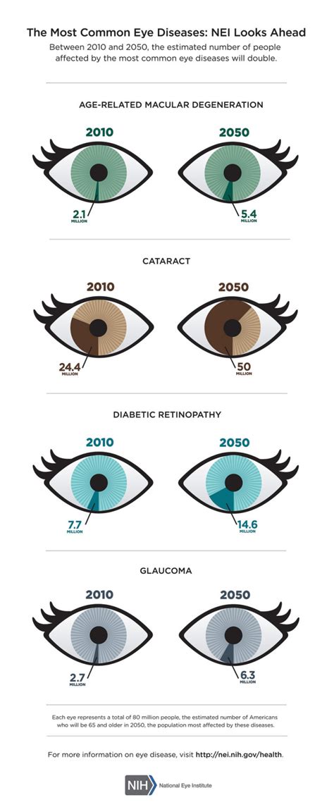 Common Eye Disease By Nih 11 10 15 Discovery Eye Foundation