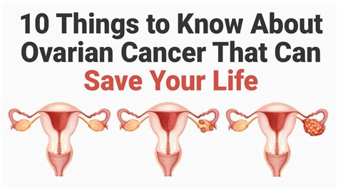 10 things to know about ovarian cancer that can save your life