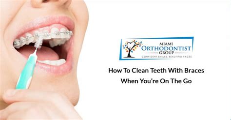 clean teeth  braces  youre    miami