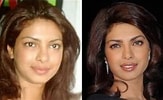 Image result for Rakhi Sawant Before and After Surgery. Size: 163 x 100. Source: mitchellslawncorp.com