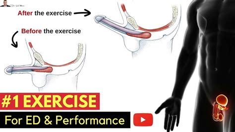 ️ 1 exercise for preventing erectile dysfunction
