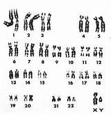 Karyotype Dna Weebly sketch template
