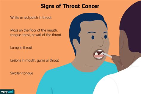 signs  throat cancer