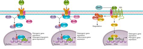 Pathophysiology Of Aortic Valve Stenosis Is It Both Fibrocalcific And