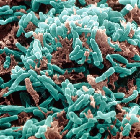 mycobacterium tuberculosis bacteria stock image  science