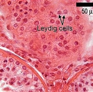 Image result for Leydig-zell-tumor des Hodens. Size: 187 x 185. Source: healthjade.net