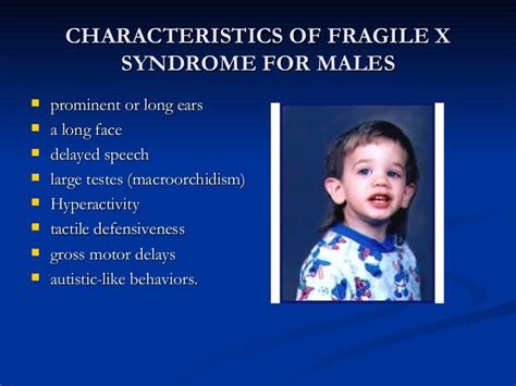 What Is Fragile X Syndrome