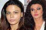 Image result for Rakhi Sawant Before and After Surgery. Size: 151 x 100. Source: www.theemergingindia.com