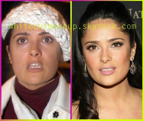 45 best botox mistakes images on pinterest before after celebrity