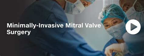 Department Of Surgery Minimally Invasive Mitral Valve Surgery