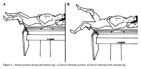dorsal lithotomy position