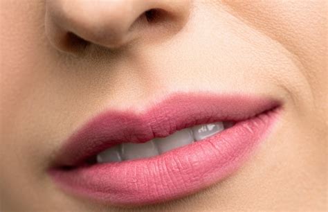 rid  vertical wrinkles   upper lip  treatments  smokers lines