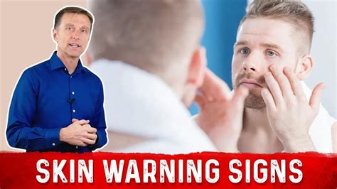 skin warning signs  diabetes