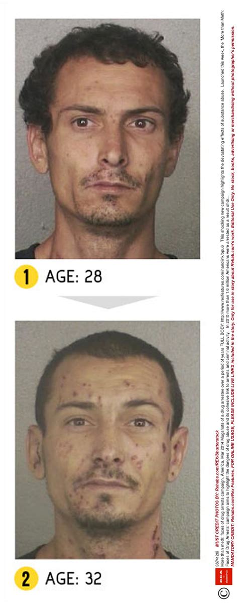 Before And After Pics Of Crystal Meth Users Are Enough To Put You Off
