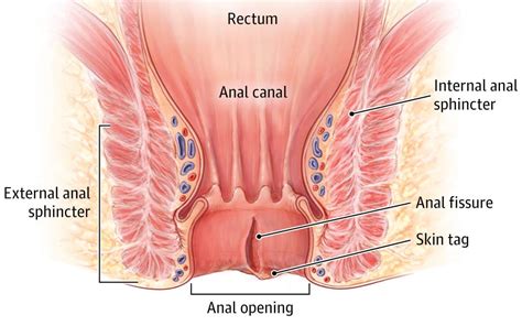 Anal Fissures A Pain In The Butt Carefirst Specialty