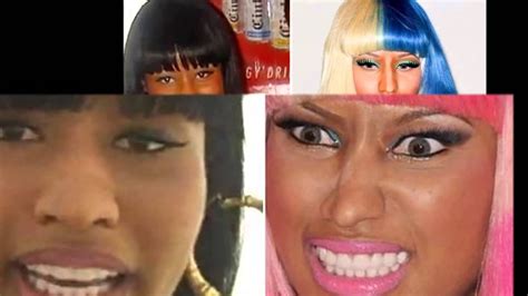 Pictures Of Nicki Minaj Before Surgery Youtube
